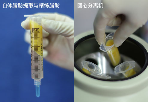 自体脂肪提取与精练脂肪, 圆心分离机