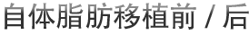 自体脂肪移植前/后