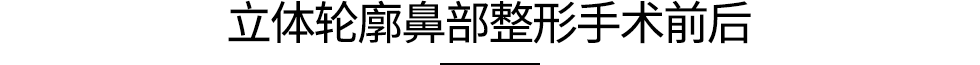 立体轮廓鼻部整形手术前后