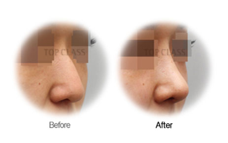 Case03 Before and After