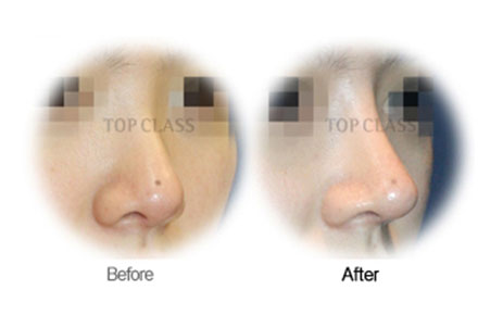 Case01 Before and After