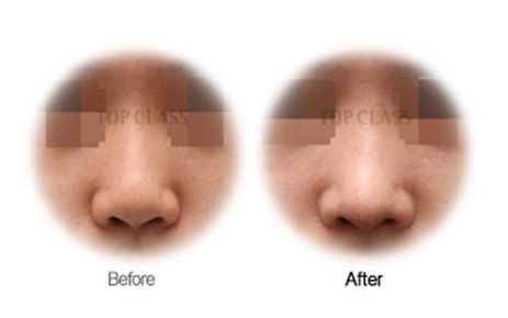 Case03 Before and After