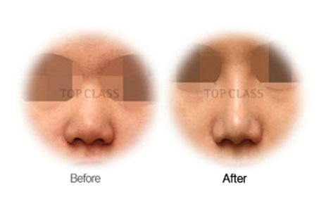 Case01 Before and After
