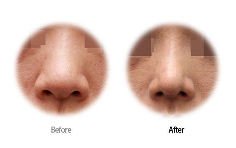 Case08 Before and After