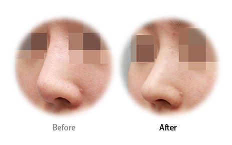 Case08 Before and After