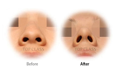 Case02 Before and After