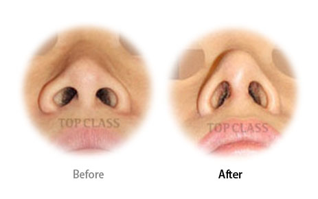Case01 Before and After