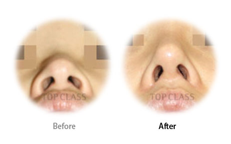 Case01 Before and After