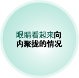 眼睛看起来向 内聚拢的情况