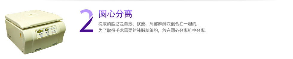 2 圆心分离 提取的脂肪是血液、浆液、局部麻醉液混合在一起的，为了取得手术需要的纯脂肪细胞，放在圆心分离机中分离。