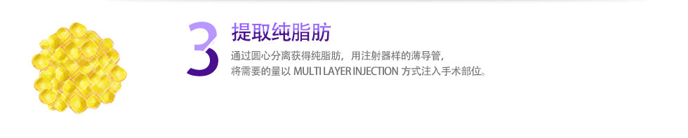 3 提取纯脂肪 通过圆心分离获得纯脂肪，用注射器样的薄导管，将需要的量以MULTI LAYER INJECTION方式注入手术部位。