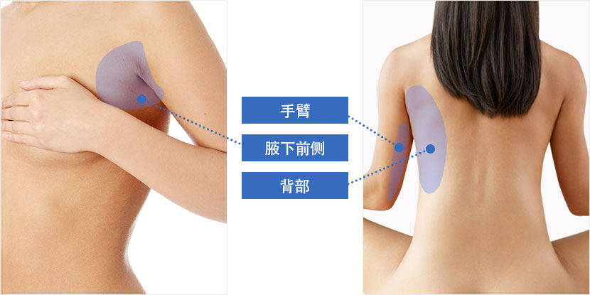 手臂, 腋下前侧, 背部