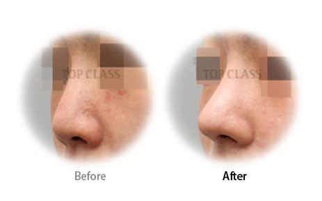 Case06 Before and After