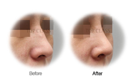 Case04 Before and After
