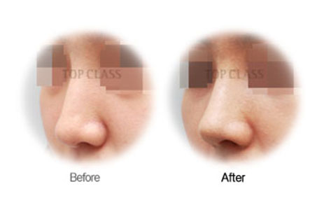 Case01 Before and After