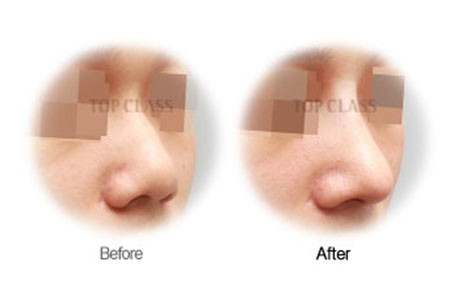 Case02 Before and After