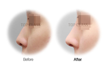 Case06 Before and After