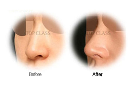 Case01 Before and After