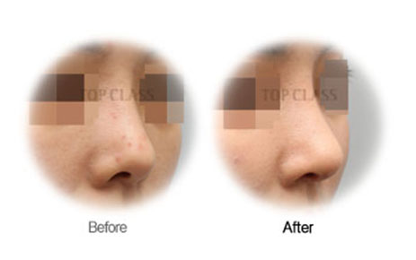 Case03 Before and After