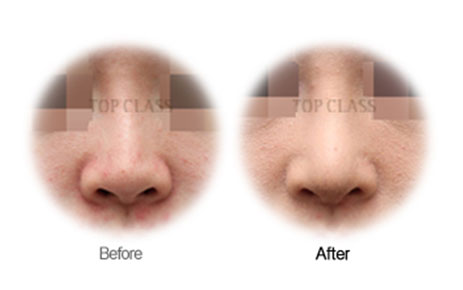 Case02 Before and After