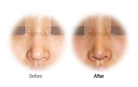 Case04 Before and After