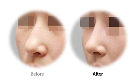 Case01 Before and After