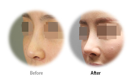 Case03 Before and After