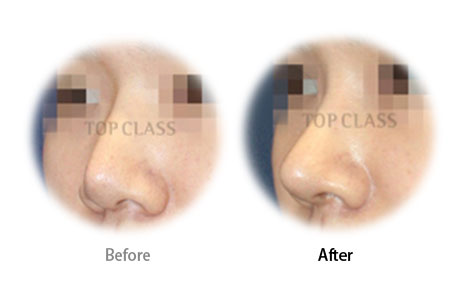 Case04 Before and After