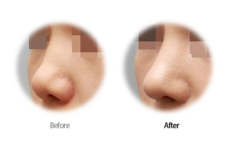 Case10 Before and After