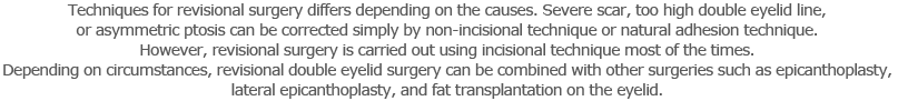 Techniques for revisional surgery differs depending on the causes. Severe scar, too high double eyelid line, or asymmetric ptosis can be corrected simply by non-incisional technique or natural adhesion technique. However, revisional surgery is carried out using incisional technique most of the times. Depending on circumstances, revisional double eyelid surgery can be combined with other surgeries such as epicanthoplasty, lateral epicanthoplasty, and fat transplantation on the eyelid.
