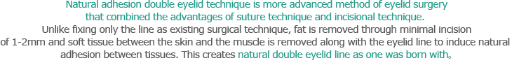 Natural adhesion double eyelid technique is more advanced method of eyelid surgery that combined the advantages of suture technique and incisional technique. Unlike fixing only the line as existing surgical technique, fat is removed through minimal incision of 1-2mm and soft tissue between the skin and the muscle is removed along with the eyelid line to induce natural adhesion between tissues. This creates natural double eyelid line as one was born with