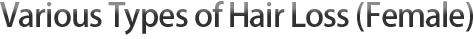 各类类型脱发种（女性）